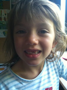 Charli loses her first tooth