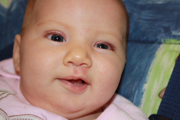 Baby blues at 3 months: Alice